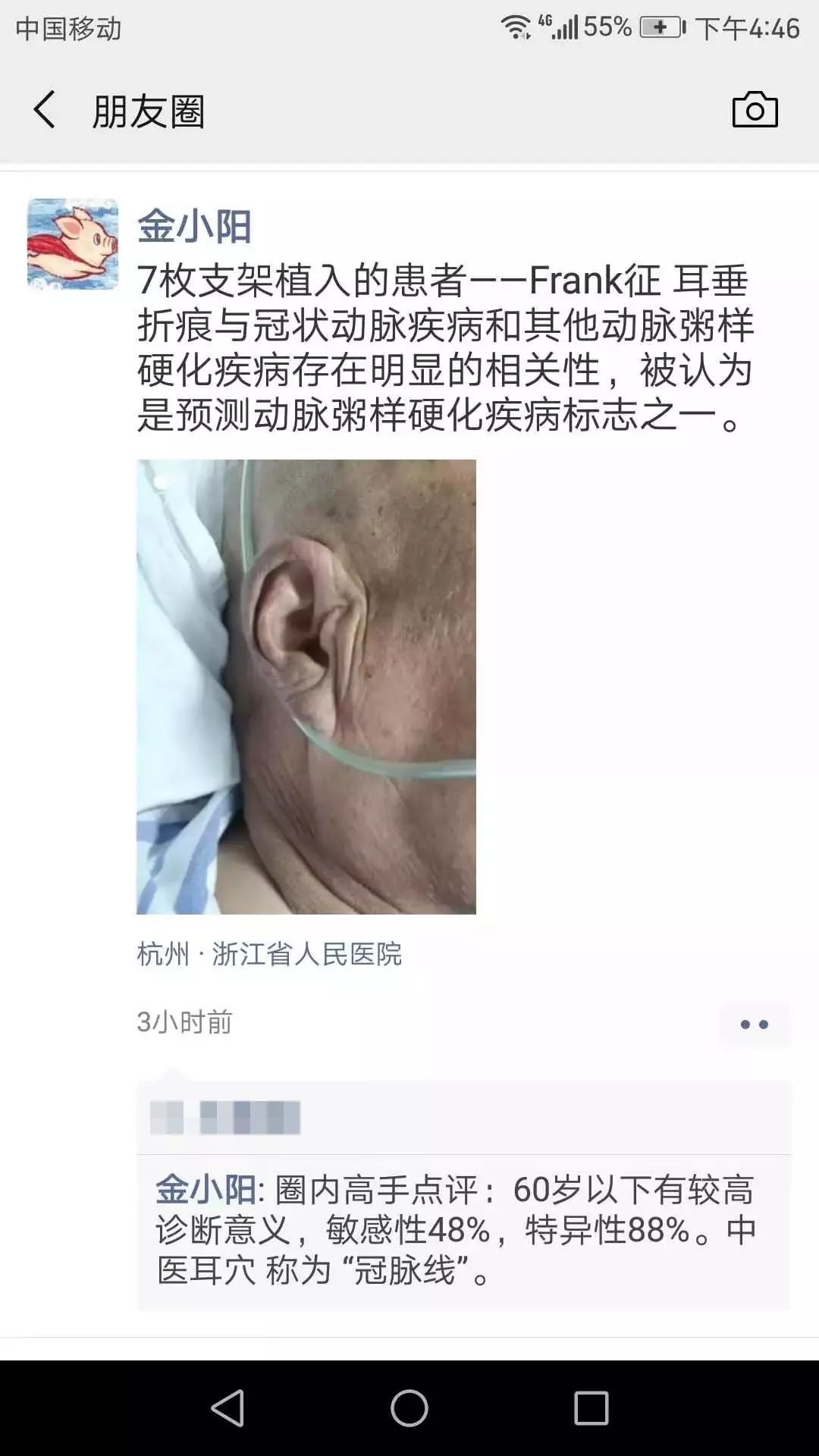 耳垂上有折痕可能有冠心病？杭州心内科医生：这回是真的！