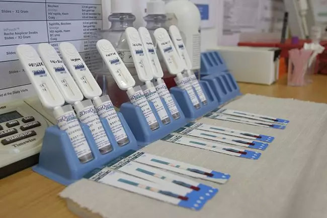 南非夸祖鲁-纳塔尔省的汤加特福利中心实验室，正在进行HIV病毒的快检