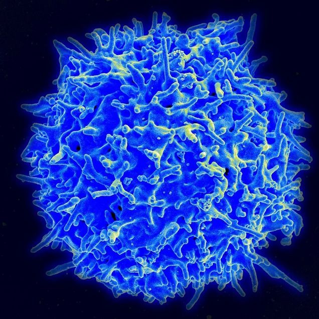 淋巴T细胞电镜扫描图。图片来源： NIAID/NIH