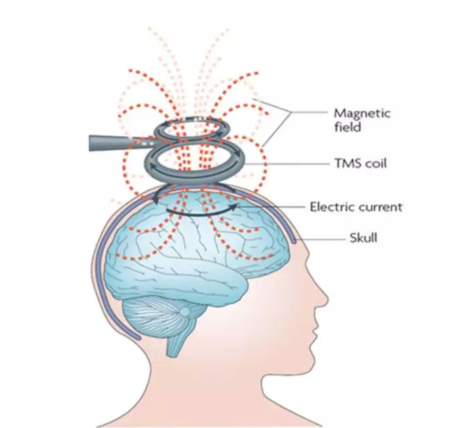 大脑上方灰色的8字形内部就是电线圈，红色的虚线就是当线圈通电时产生的磁场 | [4]