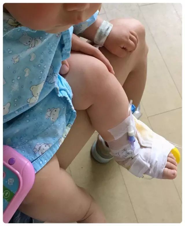 以前去医院看见宝宝绑着板子总觉得是人家崴了脚或者摔了胳膊，原来是放的留置针