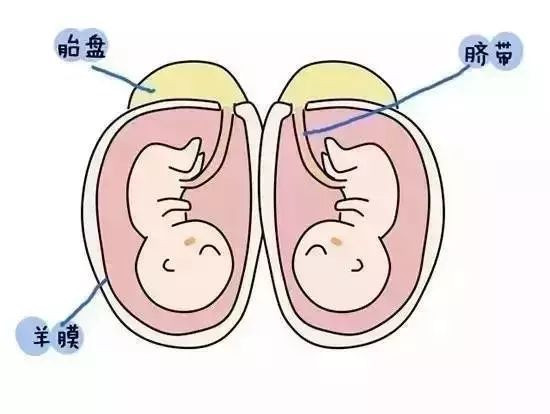 漫画解释：双胞胎是怎么形成的，为什么有的双胞胎长得一样，有的却不一样？图片 No.14