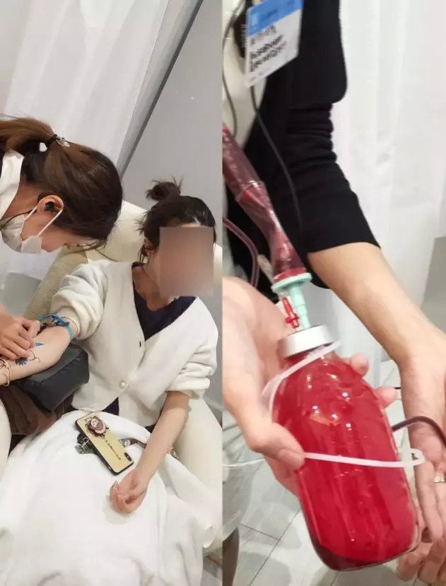 网红张某在日本体验血液净化项目