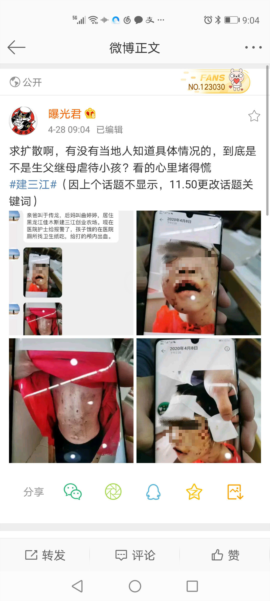 黑龙江女童被虐打进ICU始末：暴力是如何失控的