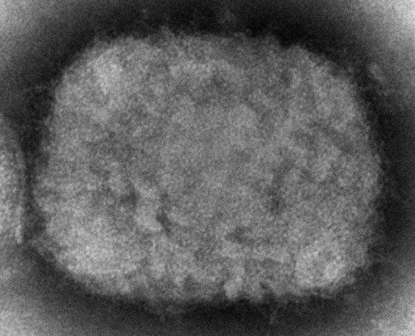 世卫组织：全球确诊37例猴痘病例，另有71例疑似病例